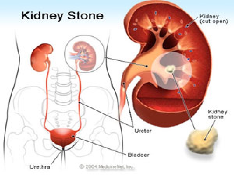 Reconstructive Urology